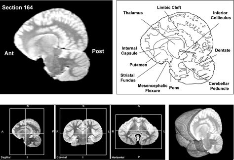 Neuroanatomy of the common dolphin (Delphinus delphis) as revealed by ...