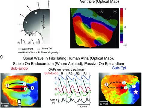 Spiral Wave Re Entry As Drivers Of Cardiac Fibrillation A Schematic