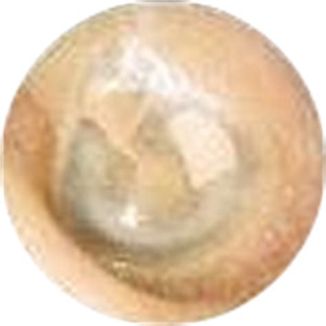 Complications of Grommets | Ear Nurse Specialist Group NZ