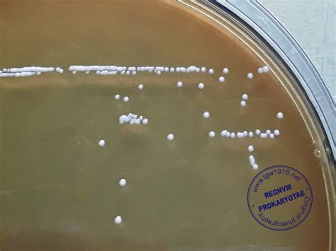 Lactobacillus Rhamnosus Gram Stain