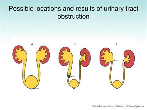 Ppt The Urinary System Powerpoint Presentation Free Download Id 1325452