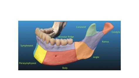 Mandibular fracture- diagnosis | PPT