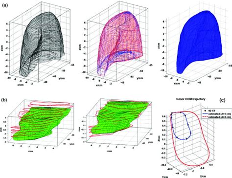 Steps In The Reconstruction Of A 4d Virtual Patient Model A Download Scientific Diagram