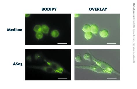 Lipid Based Adjuvants In Vaccine Development Vaccine Research