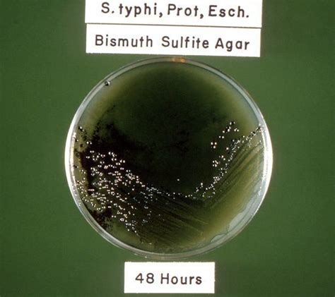 Bismuth Sulfite Agar Everything You Need To Know With Photos Videos