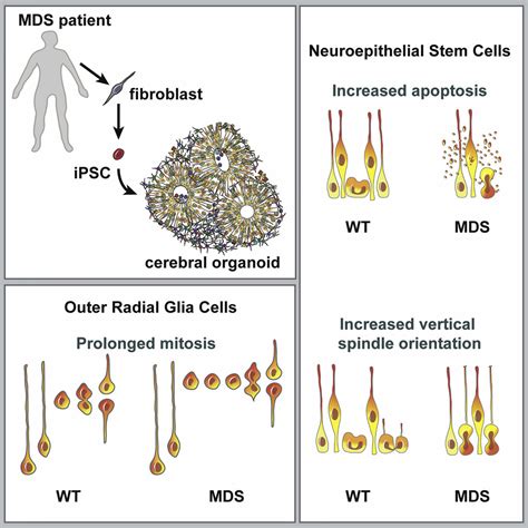 Human Ipsc Derived Cerebral Organoids Model Cellular Features Of