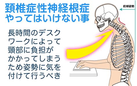 頚椎症性神経根症が治らない原因と改善策 脳卒中・脊髄損傷｜同時刺激×神経再生医療™｜東京大阪名古屋札幌福岡