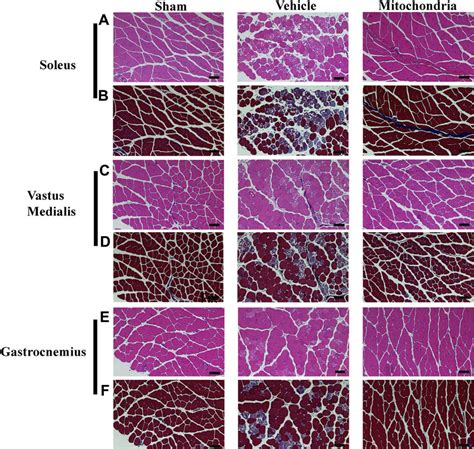 Representative Images Of Hematoxylin And Eosin H E Staining Of Soleus