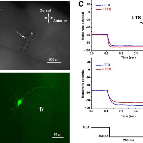 Localization And Morphology Of Parafascicular Pf Neurons A