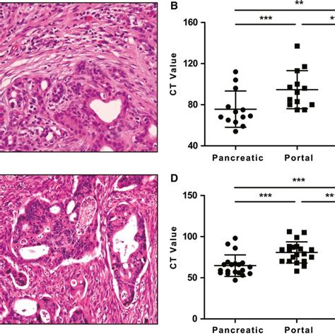 A Hematoxylineosin Staining Revealed Adjacent Pancreatic Parenchyma