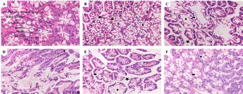 Histological Structure Of Hepatopancreas Tissue In M Rosenbergii