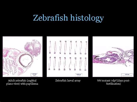 Automated Segmentation And Classification Of Zebrafish Histology Images