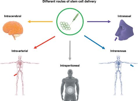 Different Routes Of Stem Cell Delivery Stem Cell Transplantation For