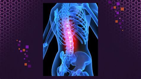 Spinal Cord Stimulation Therapy