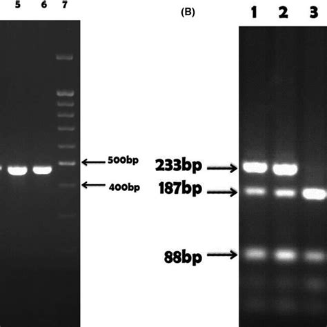 Gel Agarose Electrophoresis Of Pcr Products For Del1518 And Pcr‐rflp