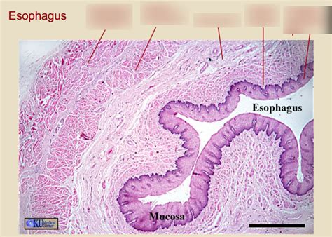 esophagus Diagram | Quizlet