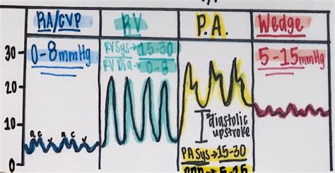 PA Catheter Ports & Waveforms ICU Nursing Concept Map - Etsy