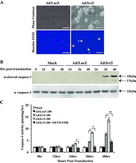 Irx5 Induced The Apoptotic Phenotype In Vsmcs Rasmcs Were Transduced