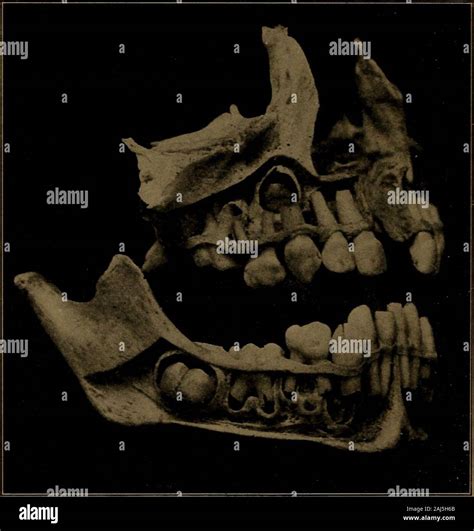 Histology of bone growth hi-res stock photography and images - Alamy