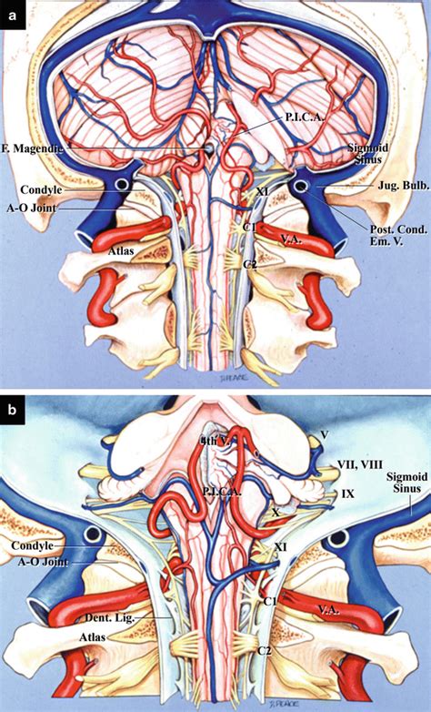 Foramen Magnum Spinal Cord