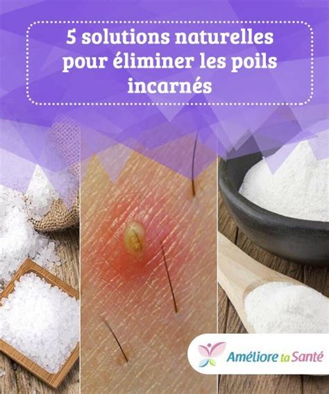 Solutions Naturelles Pour Liminer Les Poils Incarn S Poil Incarn