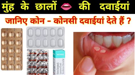 Mouth Alcer Treatment Muh Ke Chale Kaise