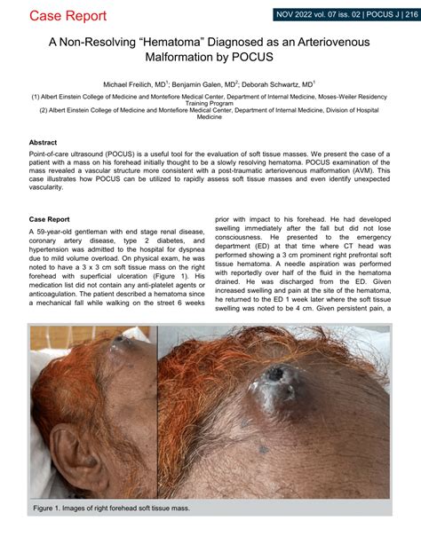 Pdf A Non Resolving Hematoma Diagnosed As An Arteriovenous