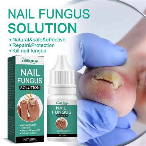 Qwang Toenail Fungus Care Fast Acting Nail Care Liquid For Fungus