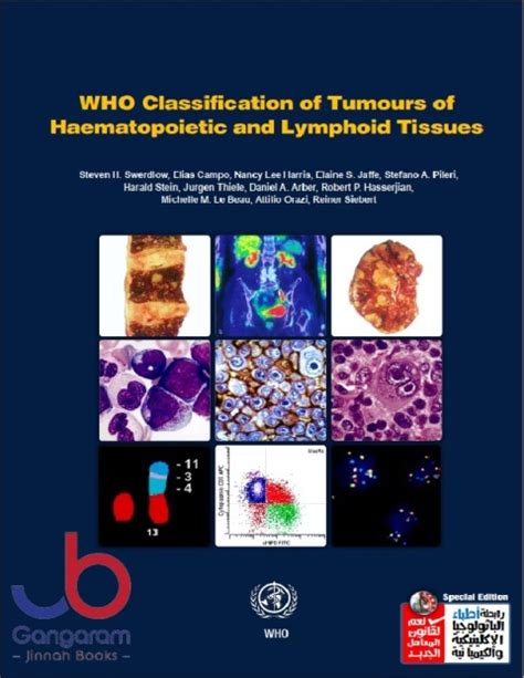 Who Classification Of Tumours Of Haematopoietic And Lymphoid