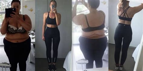 Weight Loss Blogger Simone Anderson Documents Skin Removal Surgery