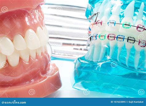 orthodontic model stock image image  cost laboratory