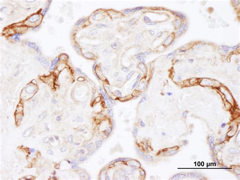 EGFR Antibody (A300-387A)