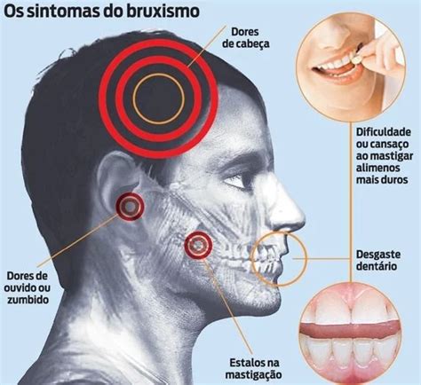 Toxina Botulínica Odonto Nowicki