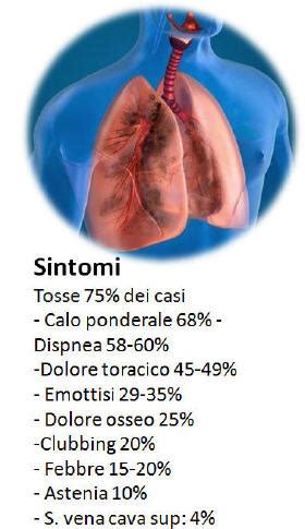 Cosa Fare In Caso Di Sospetto Di Tumore Polmonare