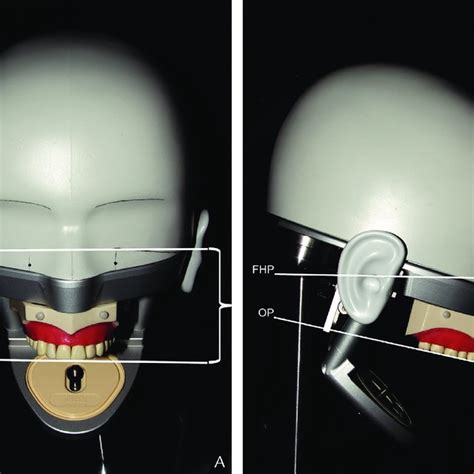 Angle Measurement On Phantom Head A Frontal View B Lateral View Download Scientific