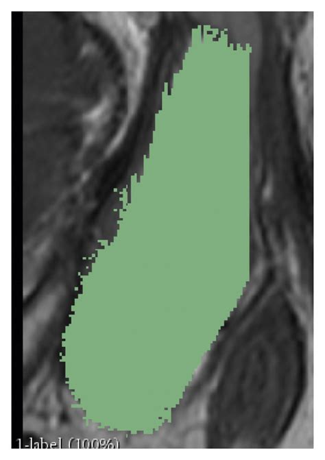 Radiomics Analysis Pipelineradiomics Analysis Pipeline For All Download Scientific Diagram