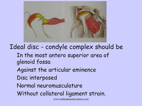 Orthodontic Splints Certified Fixed Orthodontic Courses By Indian Dental Academy Ppt