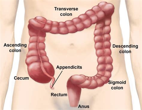 Appendicitis