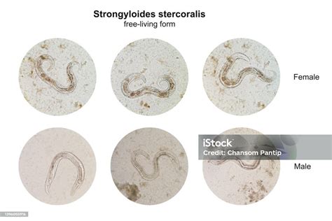 Microscopic View Collage Of Freeliving Form Male And Female Strongyloides Stercoralis In Human