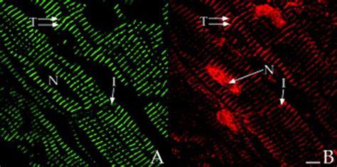 Colocalization Of Akap With Actinin And Ryr In Longitudinal