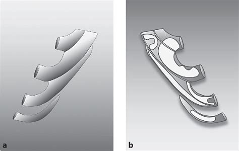 Figure 1 From State Of The Art Autogenous Ear Reconstruction In Cases