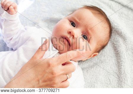 Baby Atopic Dermatitis Image Photo Free Trial Bigstock