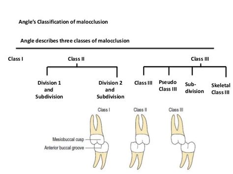 Classification of Occlusion and Malocclusion Dr. Nabil Al-Zubair