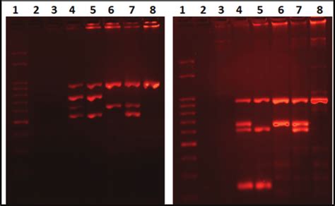 Y Chromosome Microdeletion Analysis Examples Of Both Multiplex Pcr