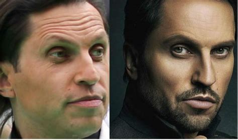 Умар джабраилов фото до и после пластики