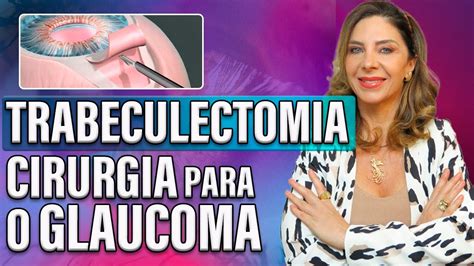 Trabeculectomia Tudo O Que Você Precisa De Saber Sobre A Cirurgia De