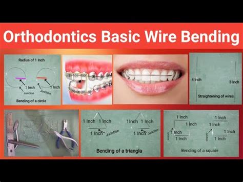 Basic Wire Bending Orthodontics Straight Wire Orthodontics Basic