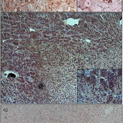 Immunohistochemical Expression Analysis Of β Catenin A Apa With Download Scientific Diagram