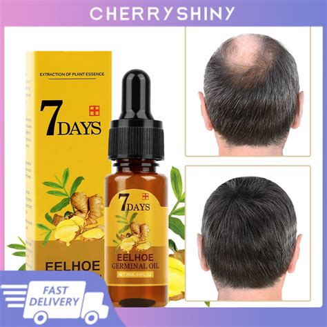 Hot！ Eelhoe Hair Growth Ginger Germinal Oil Effective Hair Loss