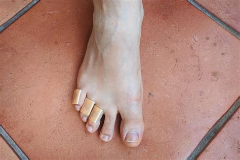 Jambes Avec Un Plâtre à Callosités Sur Les Orteils Soin De La Peau Des